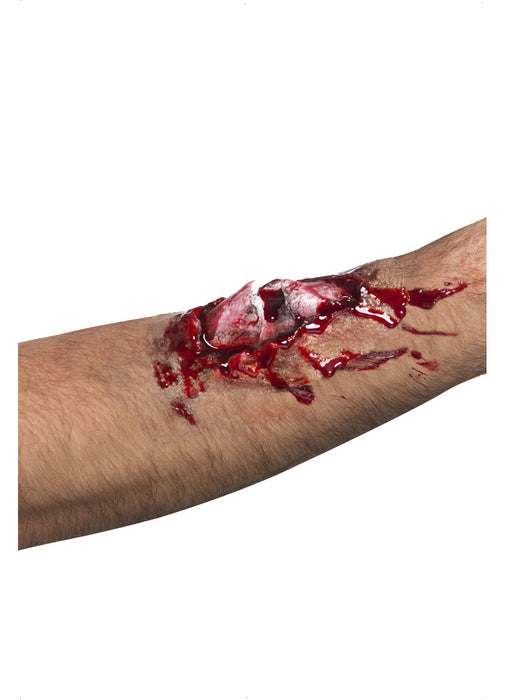 Broken Bone Latex Scar
